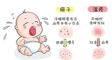 宝宝患了热疹（痱子）怎么办？ 知乎