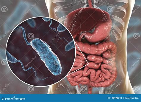 Vibrio Cholerae Bacteria in Small Intestine Stock Illustration ...