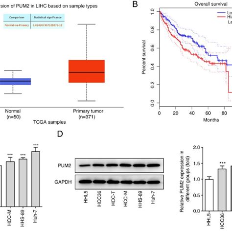 Pum Is Upregulated In Hcc Tissues And Cells A Analysis Of Pum