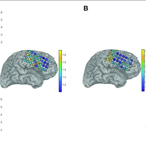 Experimental Paradigm Of Ecog Based Bci Download Scientific Diagram