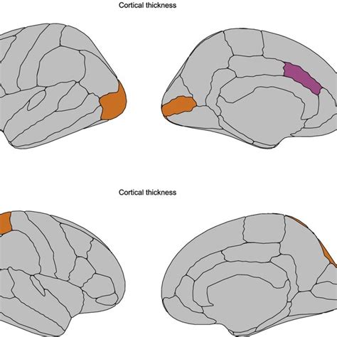 Correlation Between Cortical Thickness Regions And Social Cognition In