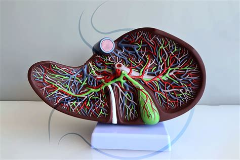 Cirrose hepática e suas complicações hipertensão portal