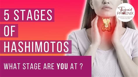 What Are The 5 Stages Of Hashimotos Disease Which Stage Are You At