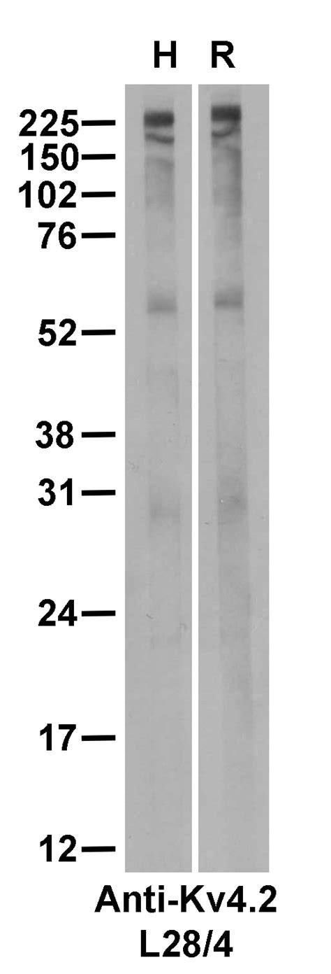 Addgene Antibody Data Hub Anti Kv K Channel L R In Western