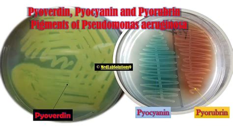 Pyoverdin Pyocyanin And Pyorubrin Pigments Of Pseudomonas Aeruginosa