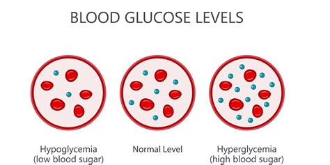 Glucose Intolerance - Signs, Symptoms, Treatment and Diet