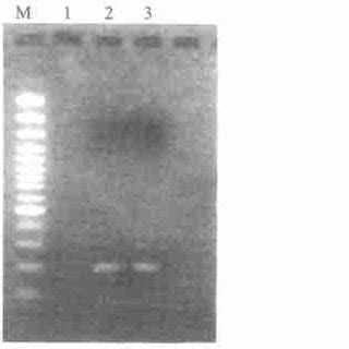 Gel Electrop Horesis Image Of PCR Products Of Two Hypervariable Region