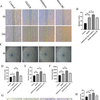 Down Regulation Of Mirna Promotes The Angiogenesis Of Huvecs A