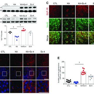 Effects Of Ex Pretreatment On Serum Ex And Hippocampal Glp R