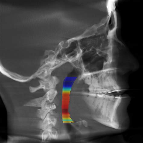 Ai Services Automatic Cephalometric Analysis Cephx