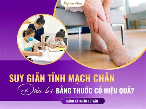 Suy giãn tĩnh mạch chân cách điều trị nhờ thuốc có hiệu quả