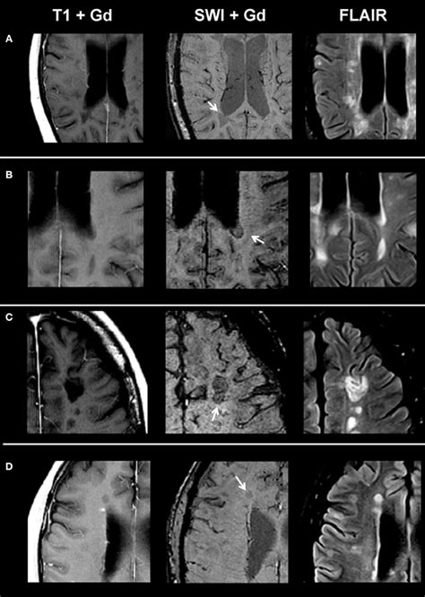 Frontiers Characterization Of Contrast Enhancing And Non Contrast