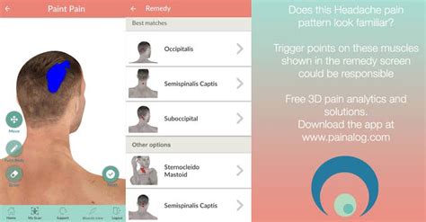 Ask a Neuro Physician Online for Head Pain Upper Right