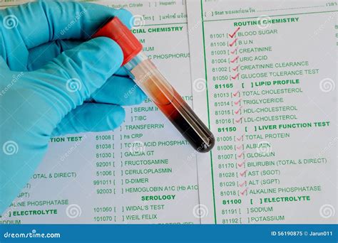 Blood Chemistry Testing Stock Image Image Of Healthcare 56190875