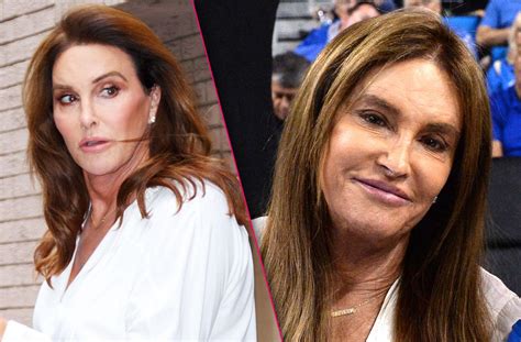 Caitlyn Jenner's Secret Nose Job Revealed