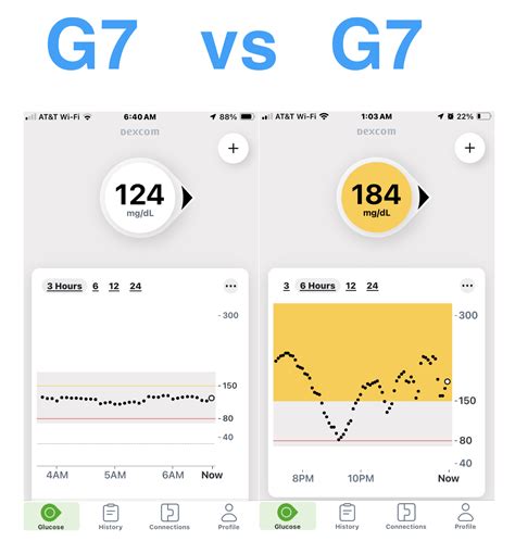 Dexcom G7 Vs Dexcom G7 R Dexcom