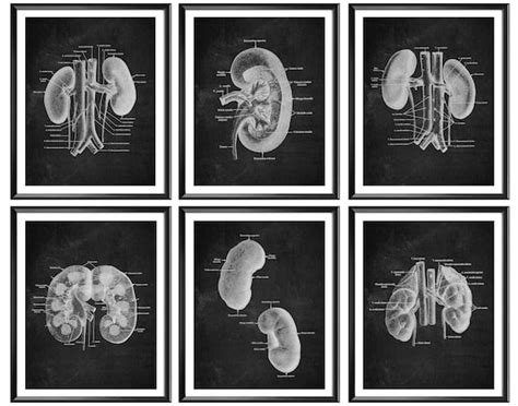 Kidney Anatomy Poster Set 6 Anatomy Art Nephrology Art Etsy