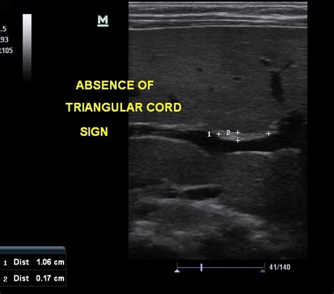 Ultrasound Training Ultra Sound Institute Sonography Courses