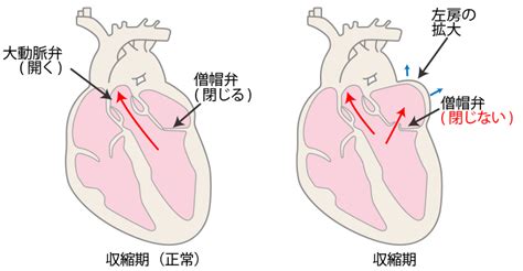 心臓弁膜症│東京心臓血管・内科クリニック│人形町・水天宮前