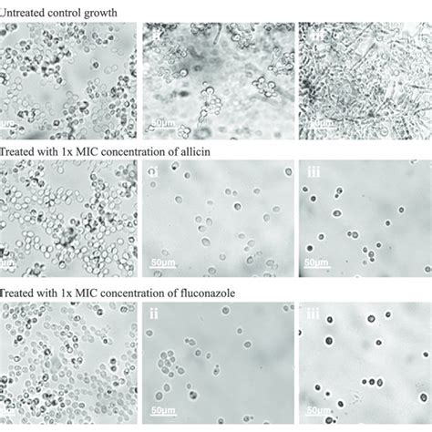 Microscopic View Of Candida Albicans Atcc 14053 Hyphae Production After