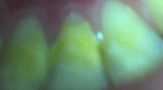 Are my teeth normal? : r/Teethcare