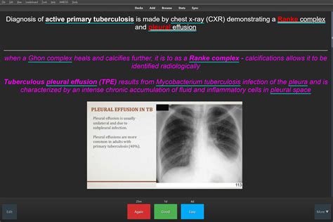 Ranke complex in active primary TB? : r/step1