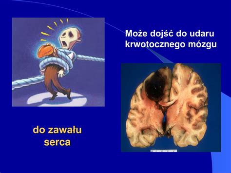 Ppt Skutki Stosowania Substancji Psychoaktywnych Powerpoint