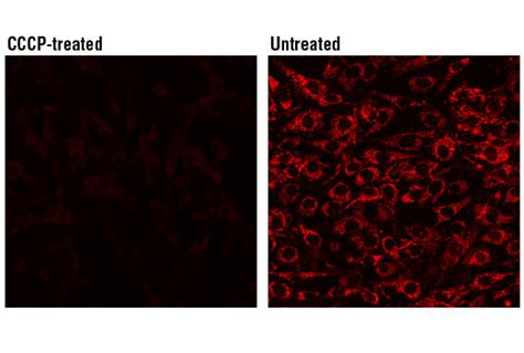 Mitochondrial Membrane Potential Assay Kit (II) | Cell Signaling Technology