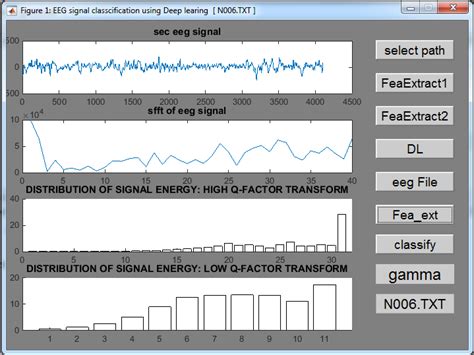 Eeg Signal Analysis Using Deep Learning Electro Soft Project Solutions