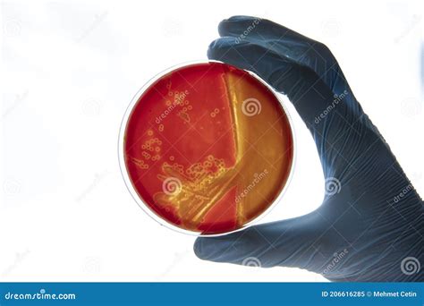 Growing Bacteria In Agar Medium In Microbiology Lab Making Streak In A