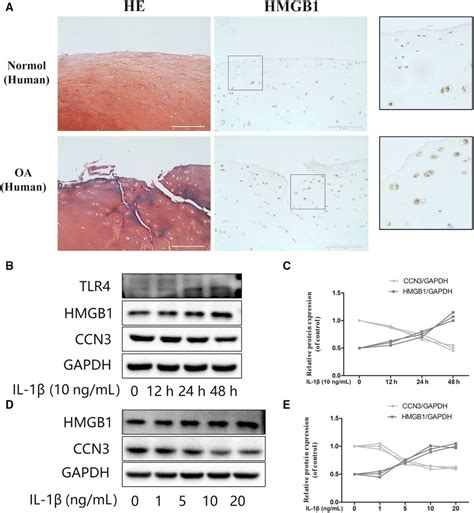 Hmgb1 Is Negatively Correlated With Ccn3 In Il‐1β Induced Download