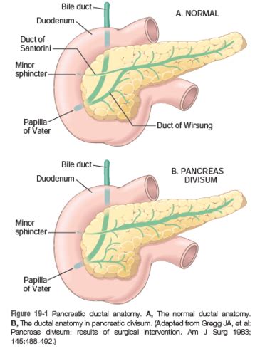 And Pancreatic Disorders Flashcards Quizlet