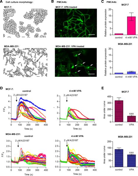 PMCA4b Localization And Function Is Impaired In The Triple Negative