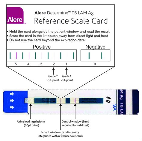 Figure Determine TB LAM Test And Reference Scale Card The Reference