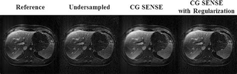 NonCartesian Parallel Imaging Reconstruction Wright 2014 Journal