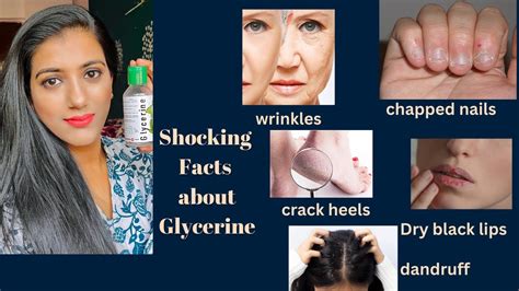 Glycerin Multiple Benefits Usage For Skin And Hair Must Watch Information Skincare Youtube