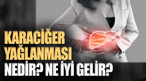 Karaciğer yağlanması nedir Hangi besinler iyi gelir