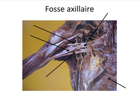 Diagramme de cours 1 membre supérieur fosse axillaire Quizlet