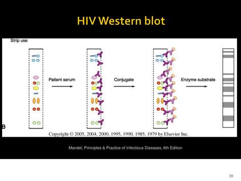 Hiv Western Blot Test