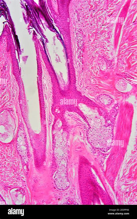 Sebaceous Gland Hi Res Stock Photography And Images Alamy