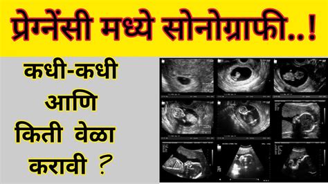 परगनस मधय सनगरफ कध व कत वळ करव Pregnancy mai