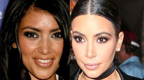 Kim Kardashian’s plastic surgery timeline – before and after surgery ...