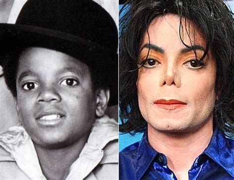 Michael Jackson Before And After Many Plastic Surgeries Celebrity