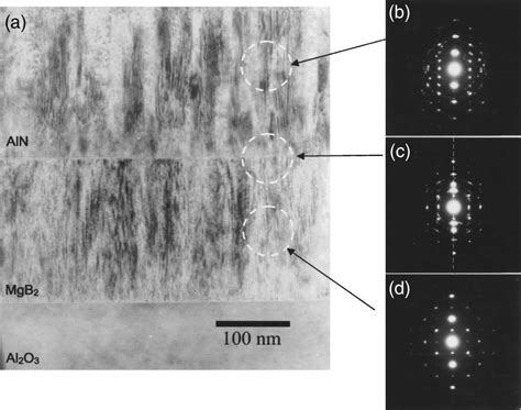 A Set Of Cross Sectional TEM Analyses Of AlN MgB 2 Layers Deposited