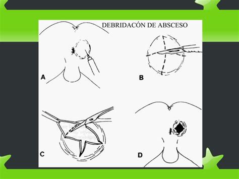 Patologia Anorectal Cirugia Medica Clinica Ppt