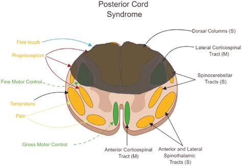 Spinal Shock Differentiation From Neurogenic Shock And Key Management