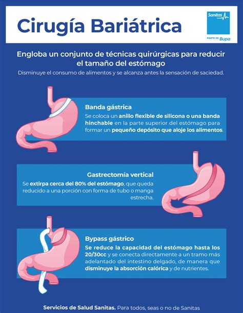 12 Cirugia Bariatrica Antes Y Despues MargaritaFiza