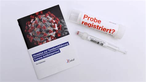 Antikörper Test in Tübingen zeigt Bis zu 17 Mal mehr Corona