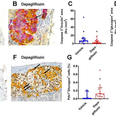 Dapagliflozin Reduced Alpha And Beta Cell Apoptosis Triple Staining Of