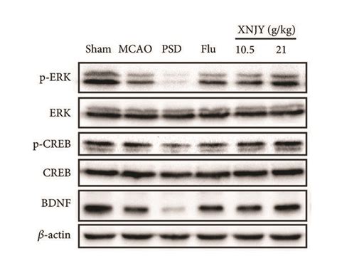 Xnjy Regulated The Bdnf Erk Creb Pathway In A Rat Model Of Psd